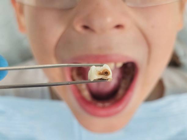 Best Emergency Pediatric Dental Care in Doniphan, MO